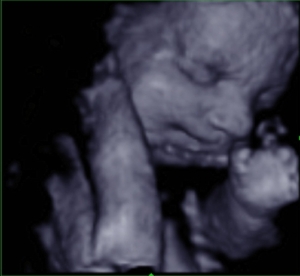 LEAD Technologies Inc. V1.01